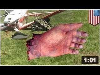 Ça fait 40 ans que John Rufty tond la pelouse, mais samedi dernier , il y a laissé une main.