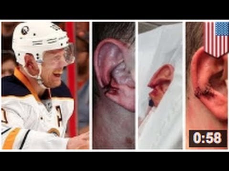 Christian Ehrhoff se fait arracher l'oreille... aïe aïe aïe...