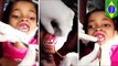 Maggots in mouth: 15 live maggots pulled from Brazilian girl’s gums