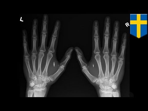 Mark of the Beast? Swedish firm's workers get microchips to gain entry, use photocopiers