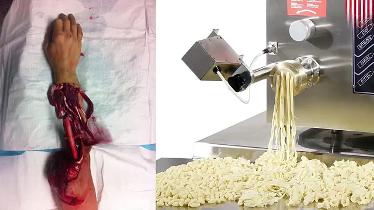 Dekhen k kese,,,,,,,kese admi ka baazu pasta machine main aaya