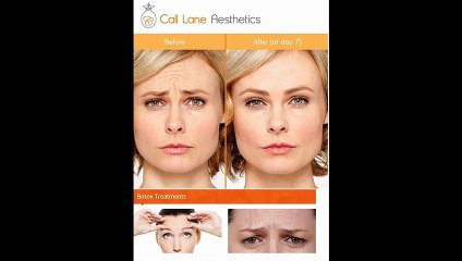 Botox Leeds - www.claesthetics.com