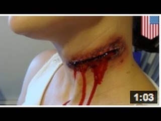 Un ado de 15 ans tranche la gorge de la mère de sa copine âgée 13 ans