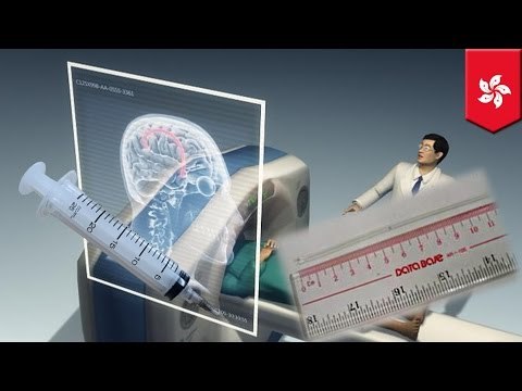 Wpadki chirurgów coraz częstsze w szpitalach w Hong Kongu