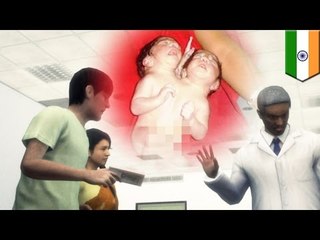 Dwugłowe dziecko urodziło się w Indiach