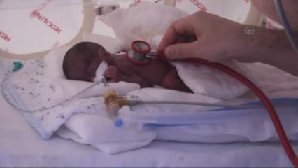 Parmak Bebek "Miray Diren", Yaşama Tutundu