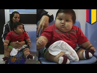 Pinakamatabang baby sa Colombia, kinuha ng charity na Chubby Hearts Foundation!