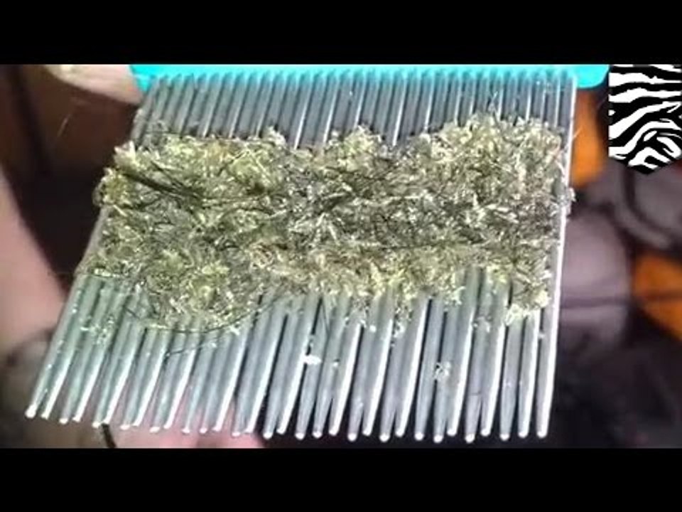 Worst head lice infestation ever: Adult shows child how to get rid of head lice with a nit comb