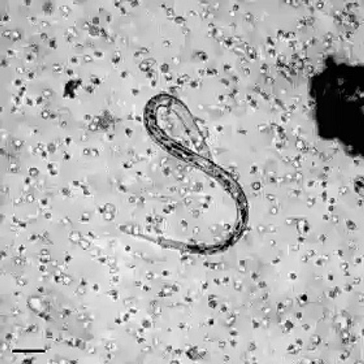 This is how our white blood cells attack a parasite