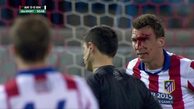 Mario Mandzukic le visage en sang après un coup de coude de Sergio Ramos