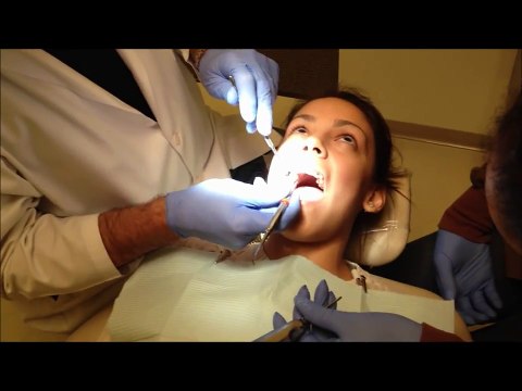 Tooth Extractions with Dr. Devore