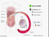 Belly Fat Linked To Type-2 Diabetes