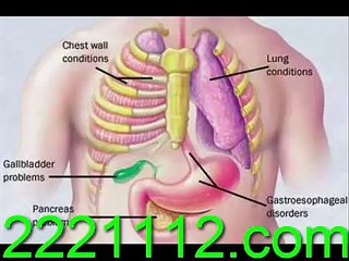 CHEST PAIN -ANGINA - اردو