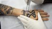 Laser Tattoo Removal - Removing straight edge tattoos