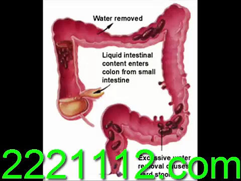 CHRONIC CONSTIPATION - اردو