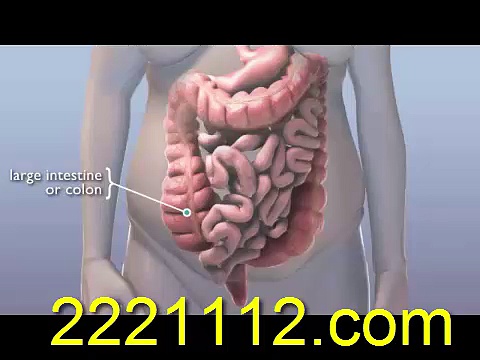 What Causes Constipation