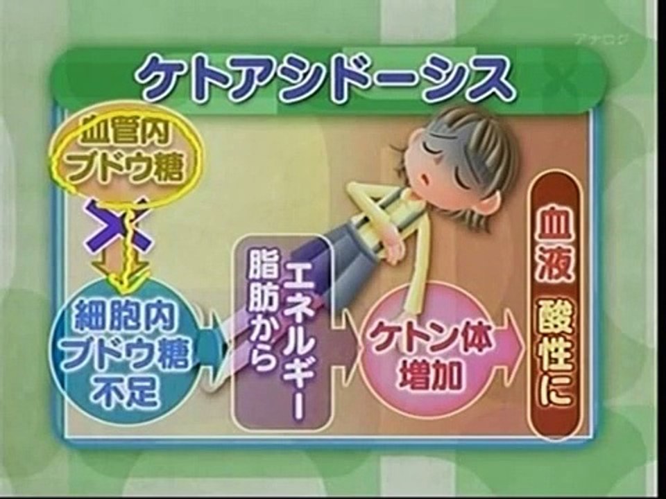1型糖尿病について