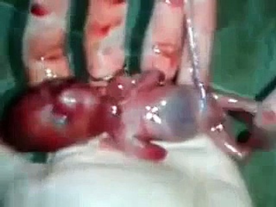 world smallest child