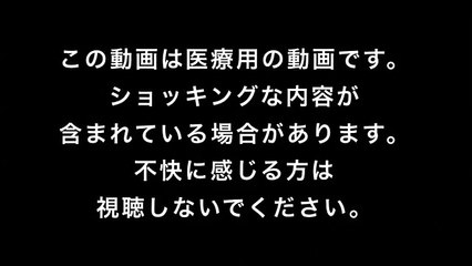 blackhead popping 08