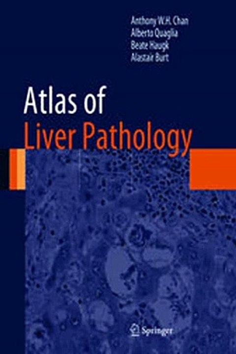 Download Atlas of Liver Pathology Ebook {EPUB} {PDF} FB2