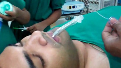 Sleep Apnea  Surgery in India-GA : Dr.K.O.Paulose FRCS