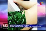 Mujer denuncia a clínica por mala práctica durante liposucción