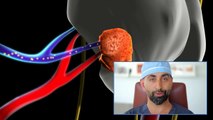 Overview of Minimally Invasive Parathyroidectomy | CENTER for Advanced Parathyroid Surgery