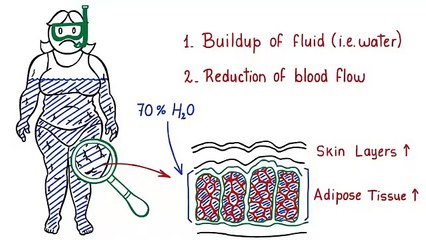 Cellulite Factor  Free presentation reveals an unusual secret to reducing the apearence of cellulite