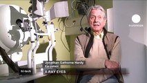 euronews hi-tech - Nueva terapia con rayos X para curar la degeneración macular