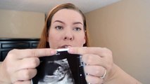 12 week pregnancy update || Symptoms, doppler, ultrasound, spreading the news!