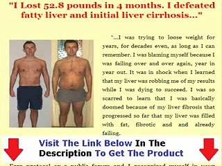 Don&#39;t Buy Fatty Liver Bible Fatty Liver Bible Review Bonus + Discount