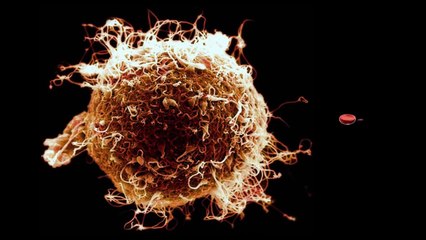 Size Comparison - From a Molecule to a Galaxy In One Single Shot (Annotations On)