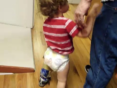 Ben Has Blounts: KAFO Brace