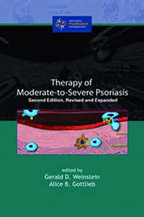 Download Therapy of Moderate-to-Severe-Psoriasi...