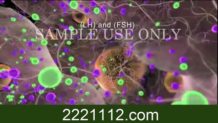 Polycystic Ovary Syndrome