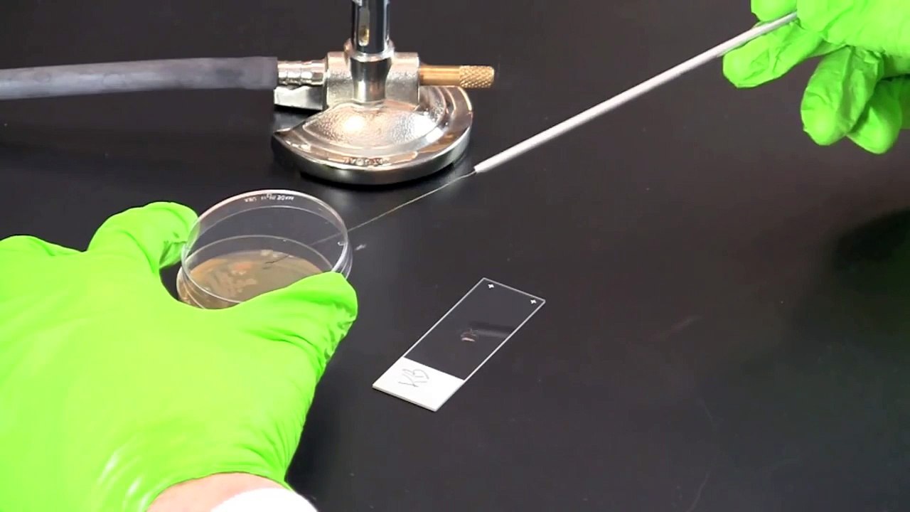 Gram Staining