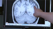 Brain Cells - Alzheimer's Society Dementia Brain Video