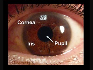 Eye Works 1: Focusing: Cornea, Iris and Lens