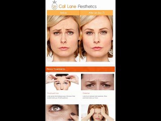 Botox Leeds - www.claesthetics.com