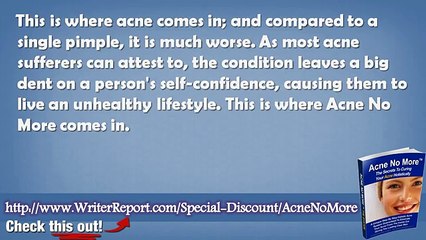 Acne No More Kit Review - Acne No More Kit