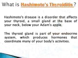 Natural Remedies for Hypothyroidism and Hashimoto