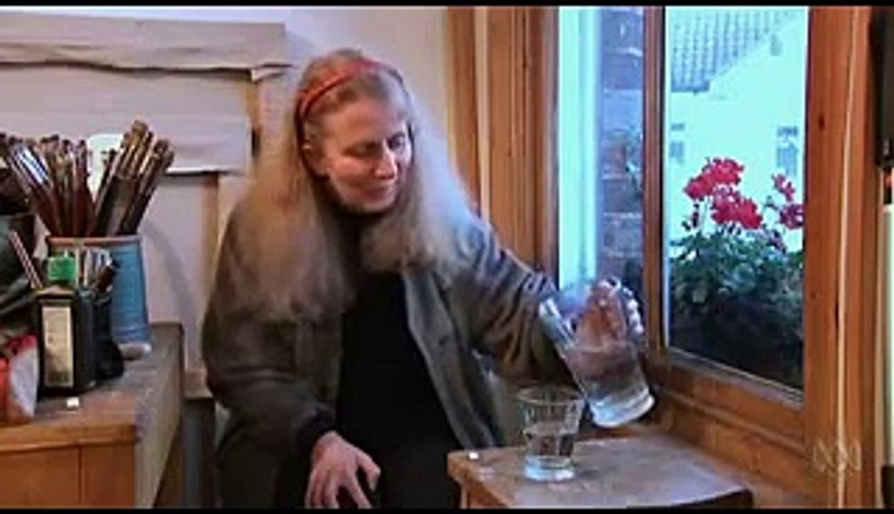 Multiple Sclerosis Cure