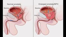 Dr. Donald Sonn - Working in the Urology Department