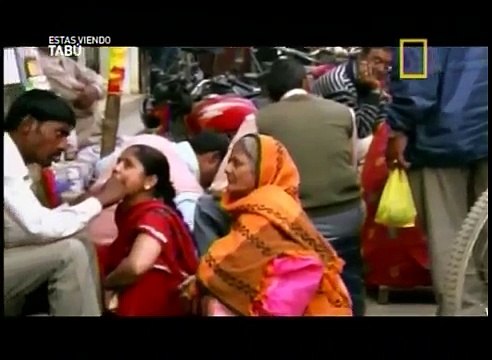 Dentistas en india TABU