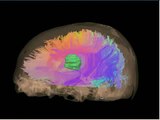 Interactive Diffusion Tensor Tractography Visualization for Neurosurgical Planning