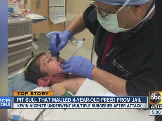 Dog that attacked an Arizona boy 'freed' from jail due to skin cancer