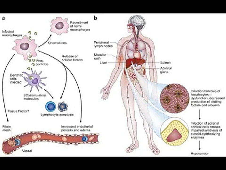 Woman dies of Crimean Congo Hemorrhagic Fever-Oh My