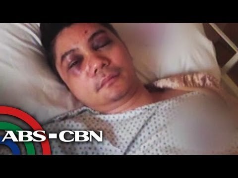 Vhong Navarro undergoes reconstructive Surgery