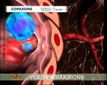 Variety of sciences, 3D medical animation produced by Virtual Point