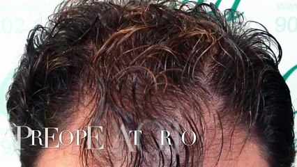 CLINICAS CETA CAPITAL www.injertodepelo.es